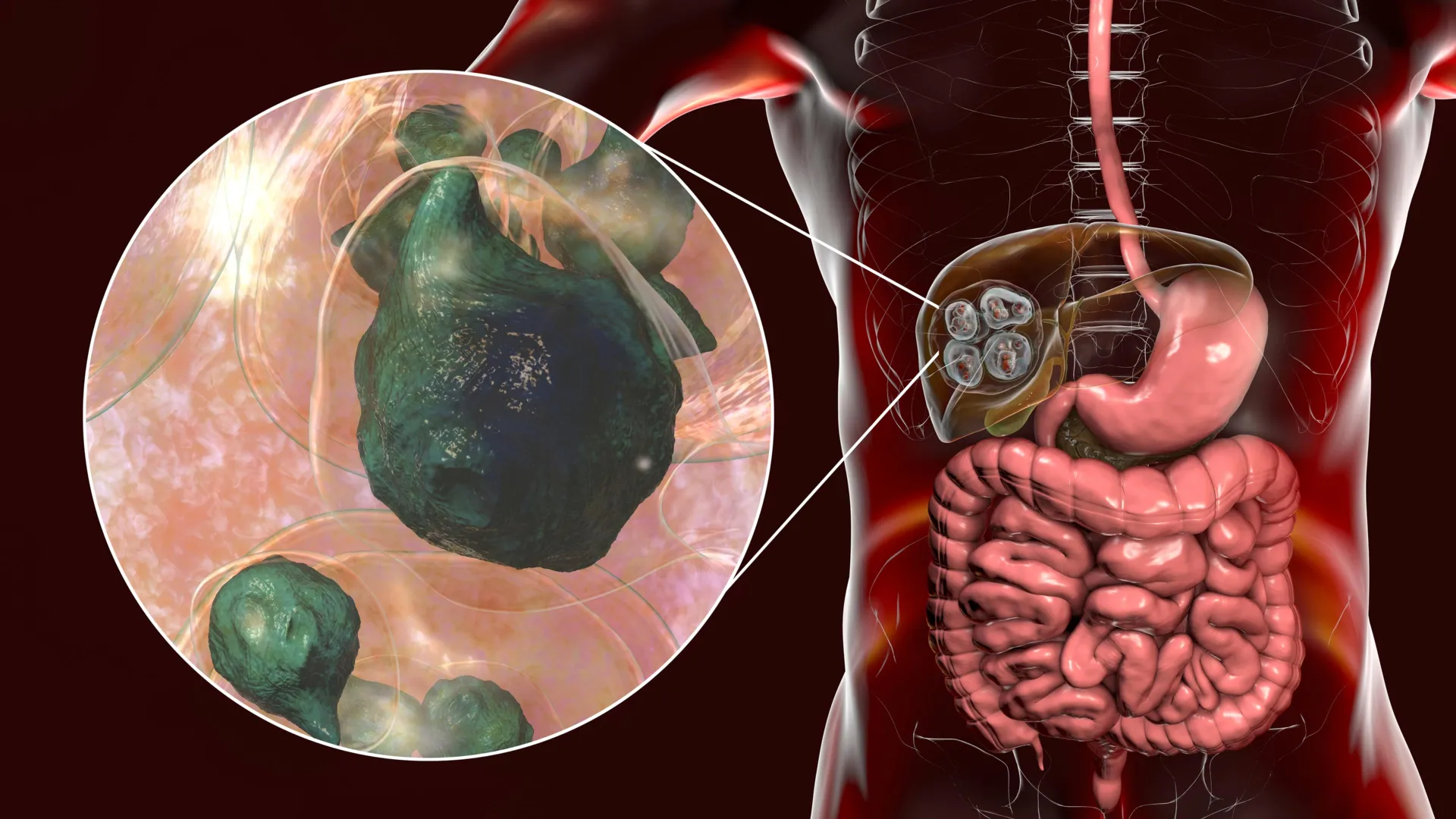 The deadly tapeworm spreading across America has reached the Pacific Northwest