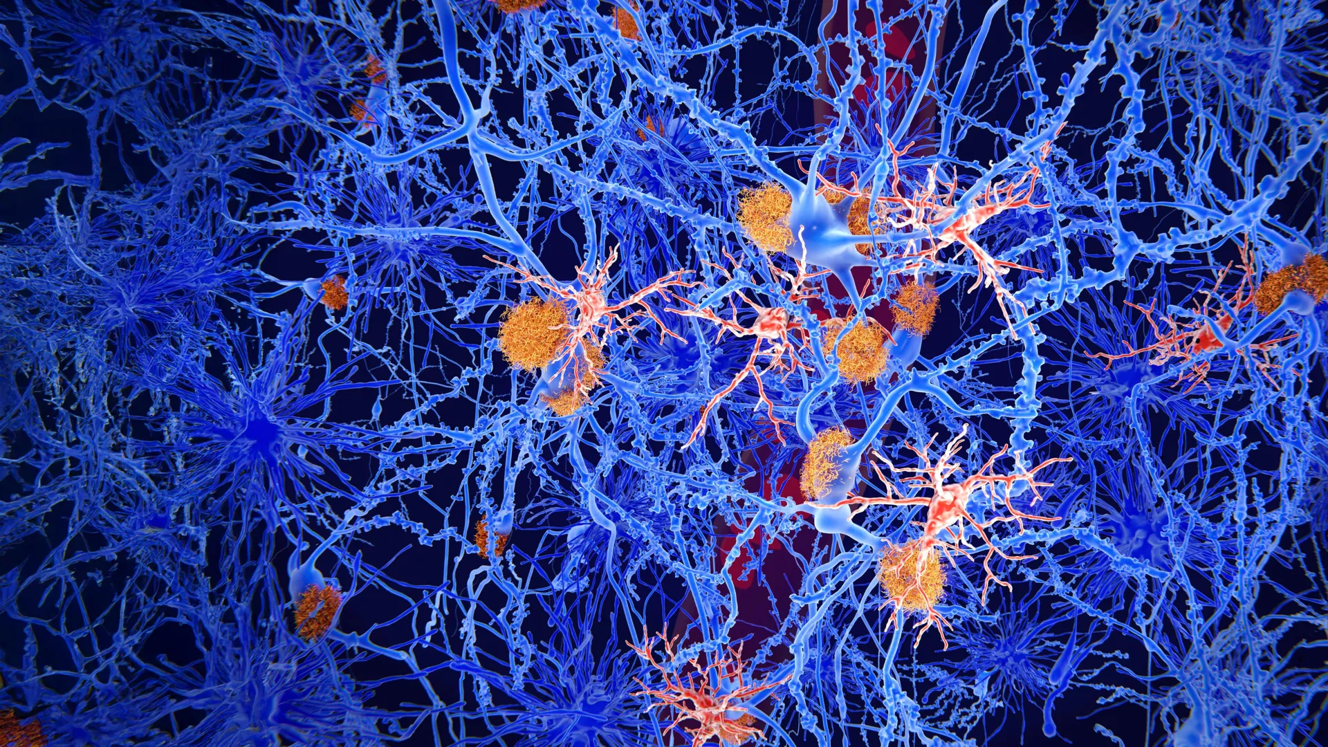 Scientists reprogram brain immune cells to fight Alzheimer’s