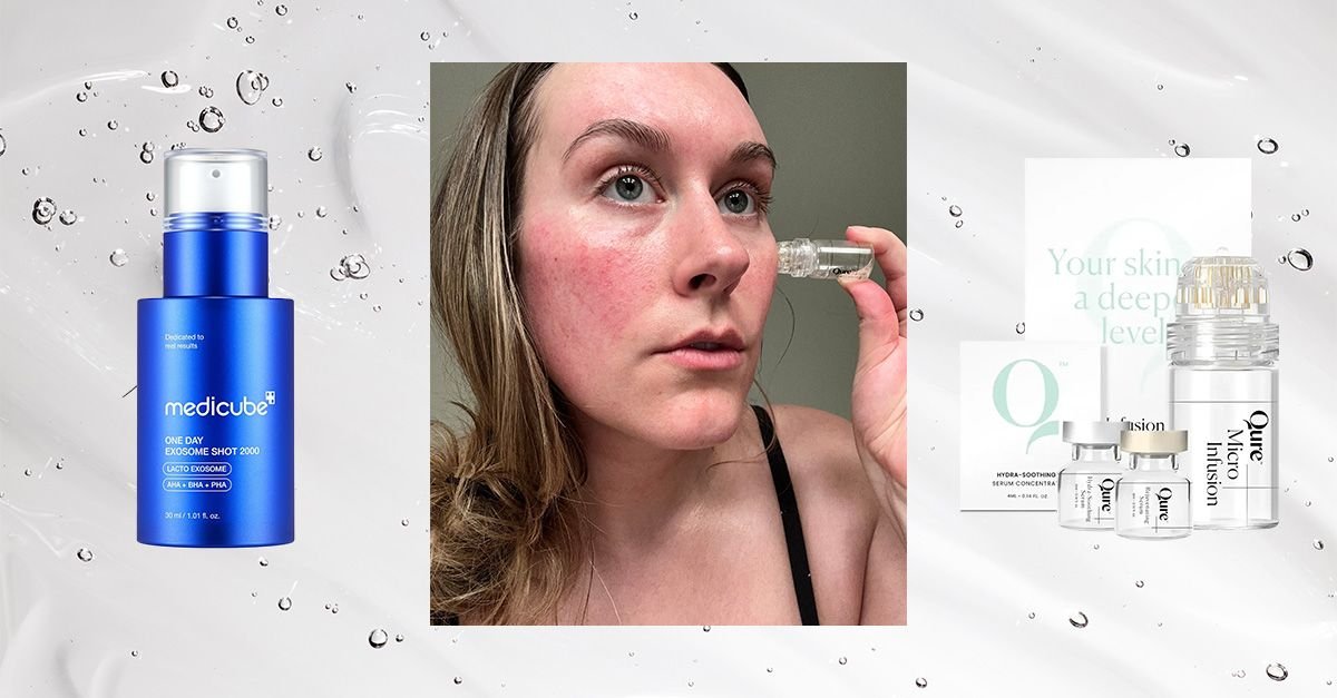 Skip the Dermaroller—2 Effective Alternatives for Great Skin