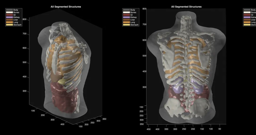 Midjourney Medical goes from AI image generation to full-body ultrasounds