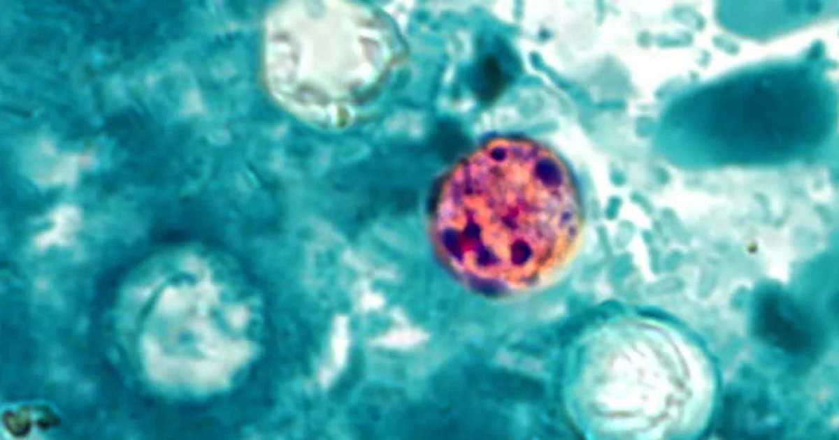 Lettuce or salad greens could be source of diarrhea-causing illness, Michigan health officials say