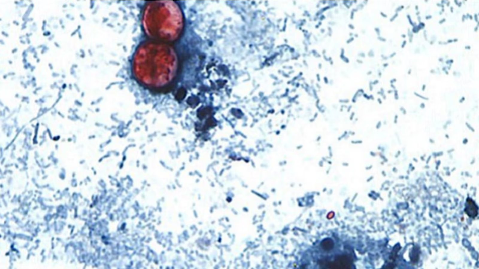 Cyclosporiasis outbreak linked to shredded lettuce served at some Taco Bell locations: Source