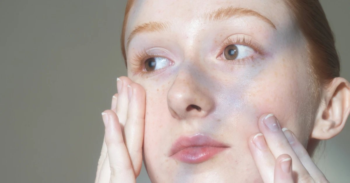 Best Acne Treatments for Teens 2026, According to Dermatologists