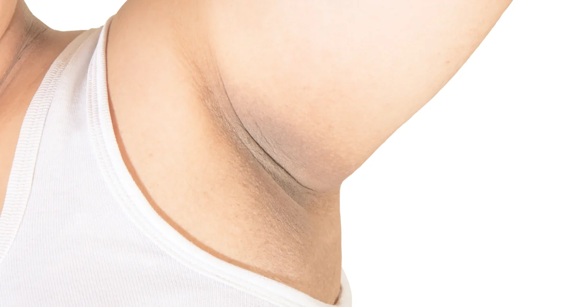 Do Deodorant Concealers Work? Dermatologists Weigh In on Safety