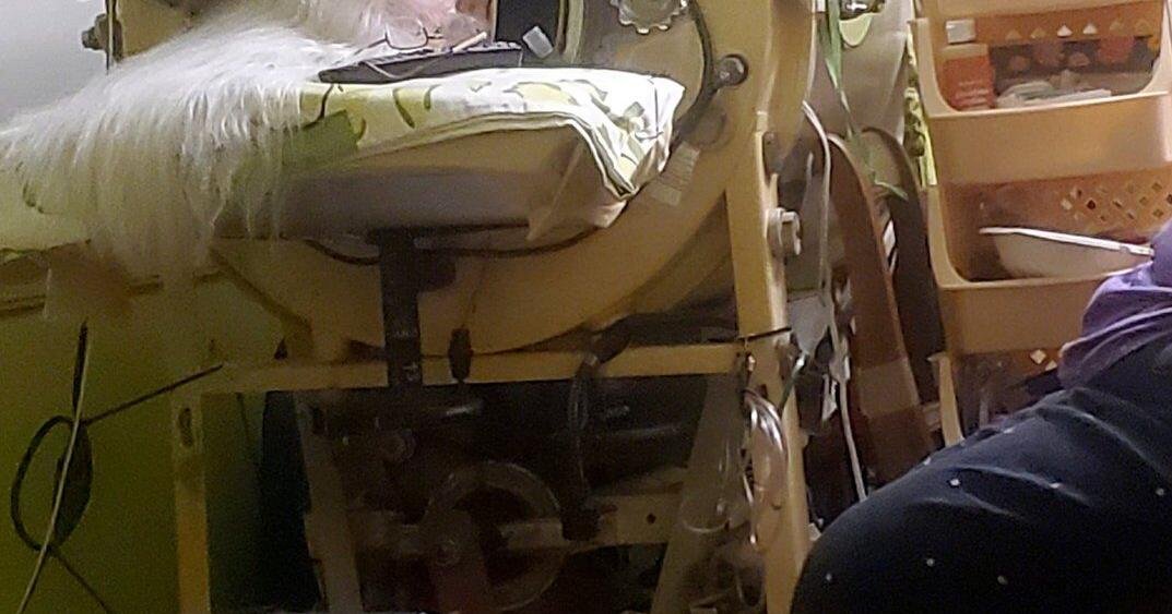 Martha Lillard, last US polio patient using iron lung, dies at 78 in Oklahoma