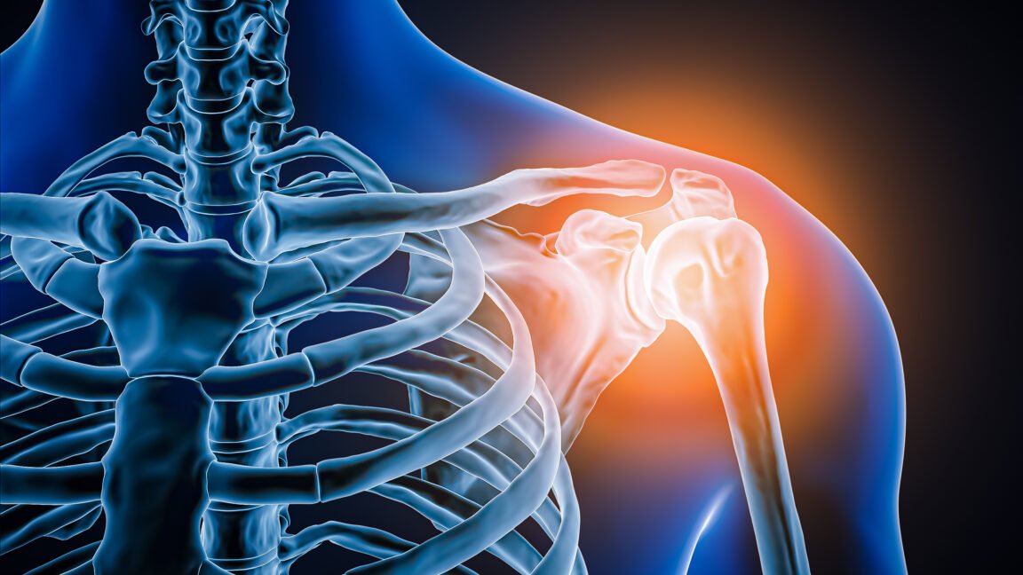 Doctors took a look at man’s painful shoulder—they found the joint was missing