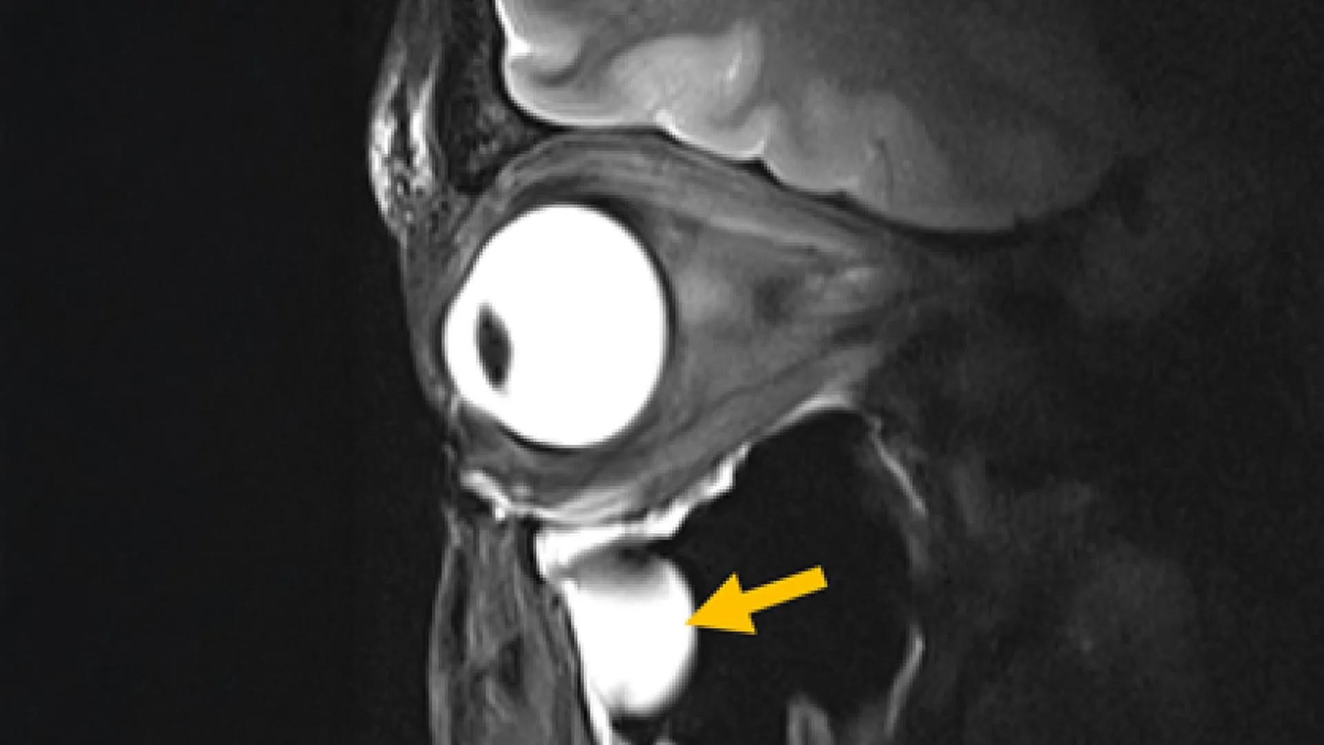 New MRI breakthrough reveals the brain and eye like never before