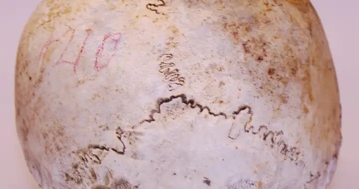 Skull found in 1975 belongs to Uxbridge, Ont. WWI veteran: police