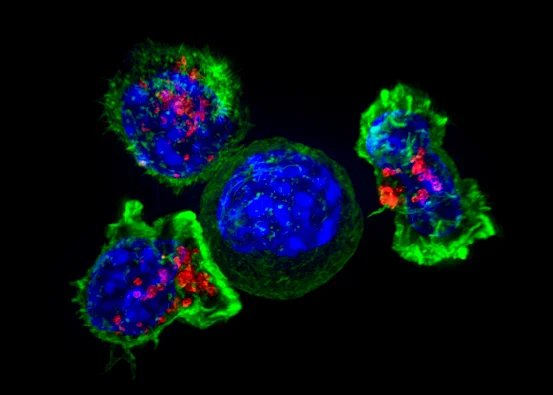 CAR T Revolutionized How We Treat Blood Cancers. Now It’s Closing In on Solid Tumors.