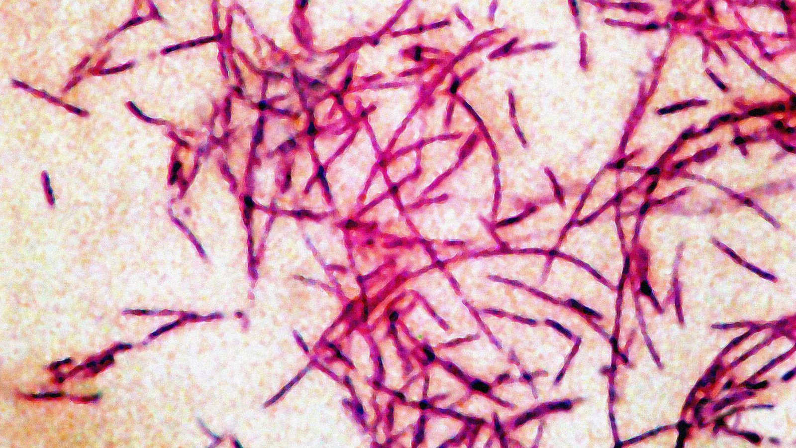 3rd person dies from Legionnaires’ disease in New York City