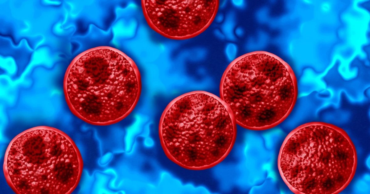 Michigan reports two deaths linked to cyclosporiasis outbreak