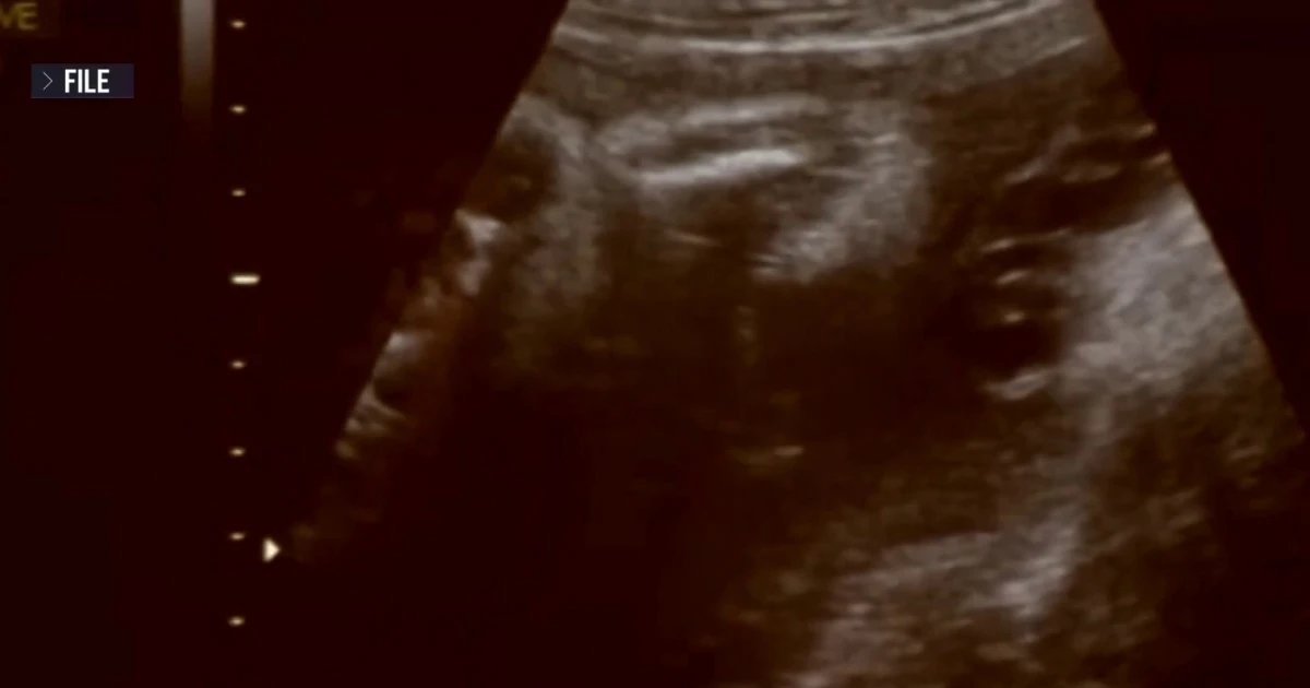 Custody battle between biological parents and surrogate