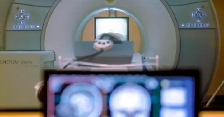Clinics, technicians unsure of Alberta’s new self-referral method for health tests