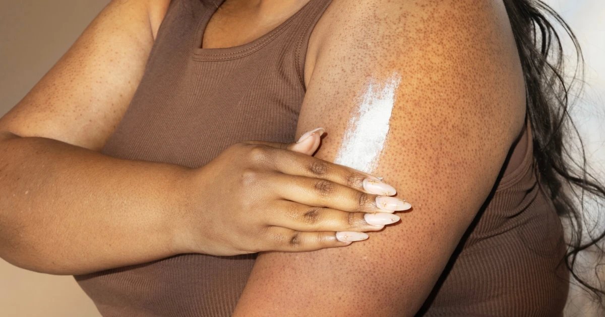 Best Keratosis Pilaris Treatments in 2026 for Smooth, Bump-Free Skin