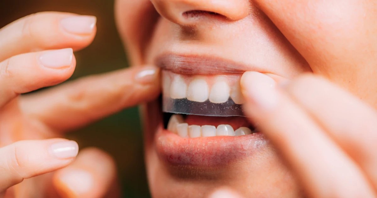 We Tested the Best Teeth Whitening Strips of 2026 — Here’s What Actually Works