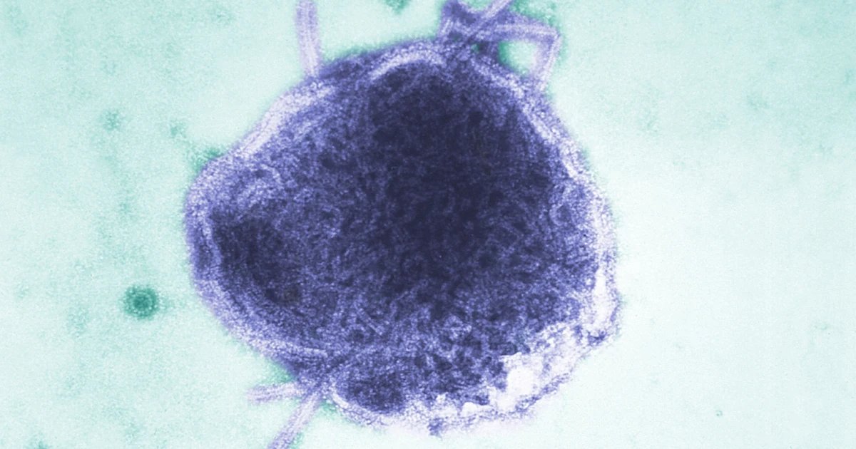 An infant in Pennsylvania is one of the measles deaths reported this week