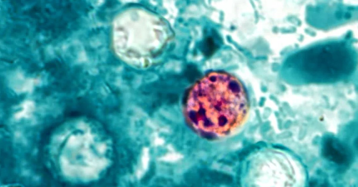 Michigan reports two deaths in cyclosporiasis outbreak