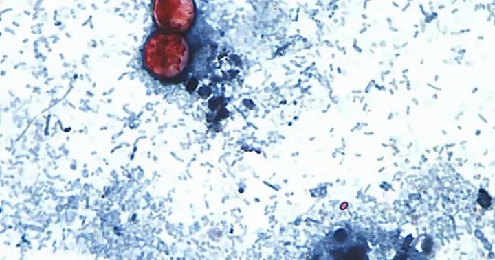 Michigan reports first U.S. deaths from multi-state cyclosporiasis outbreak – National