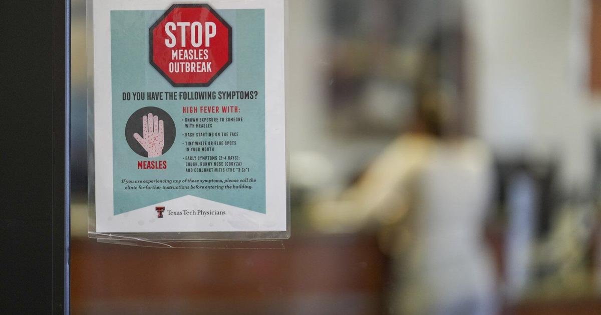 Canada has half as many measles cases as U.S.: WHO data