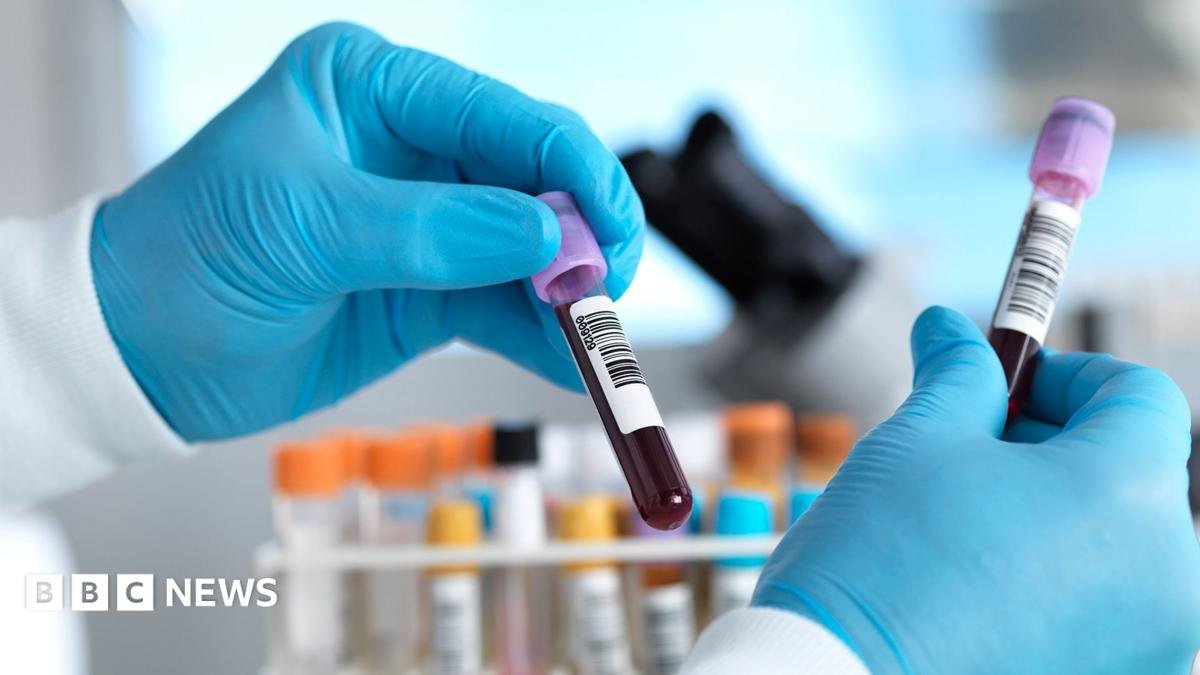 England set to eliminate hepatitis C