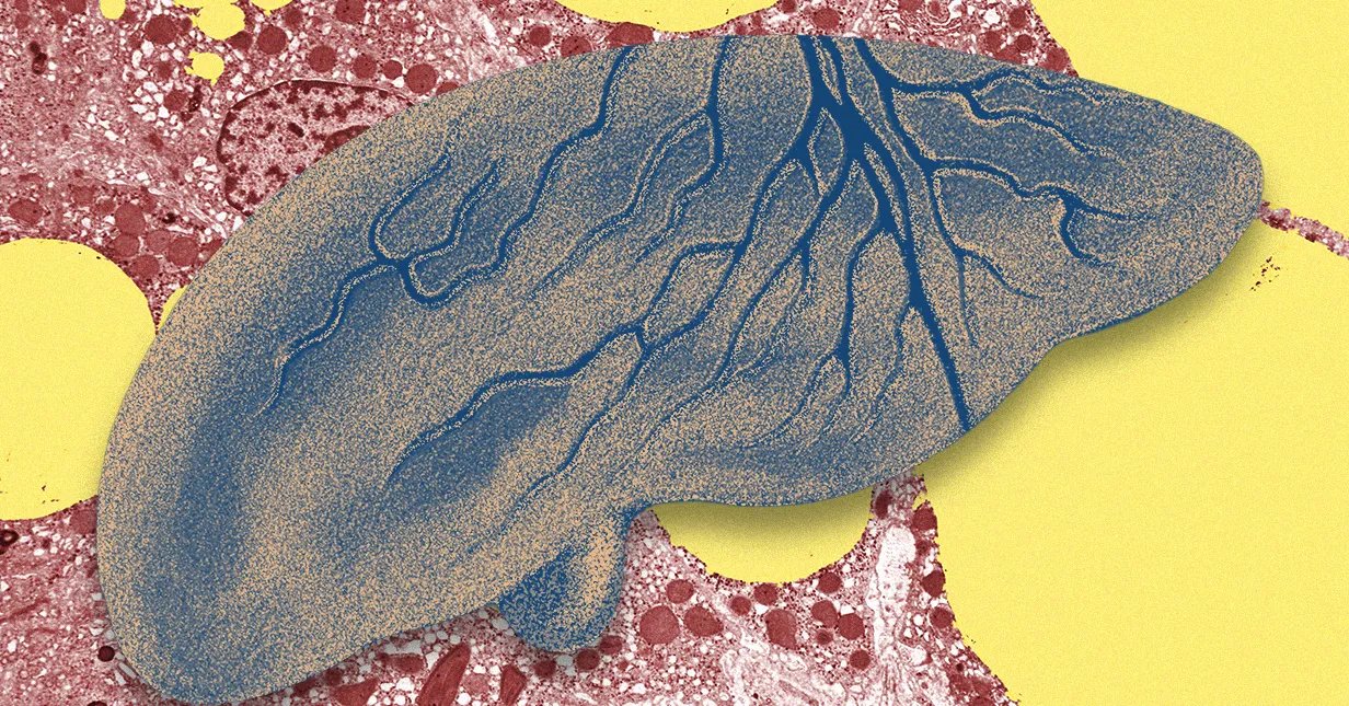 There’s a Fatty Liver Epidemic. AI Could Help Get Ahead of It