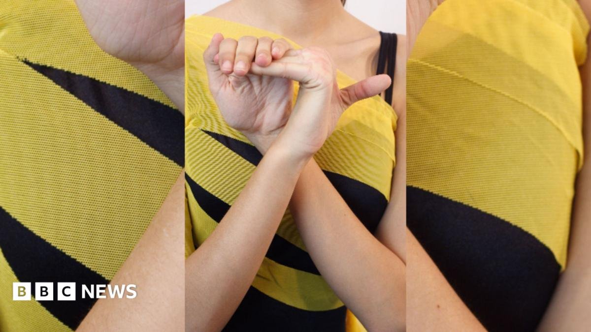 What are the symptoms of Hypermobility Spectrum Disorder?