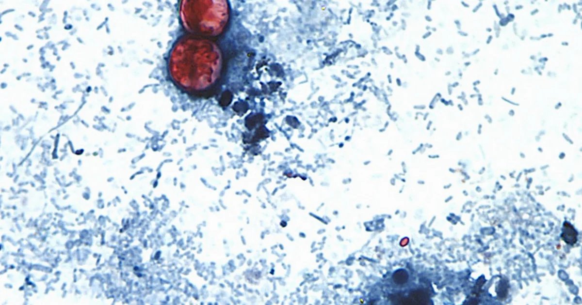 Cyclospora outbreak linked to recalled iceberg lettuce tied to 3 more states, FDA says
