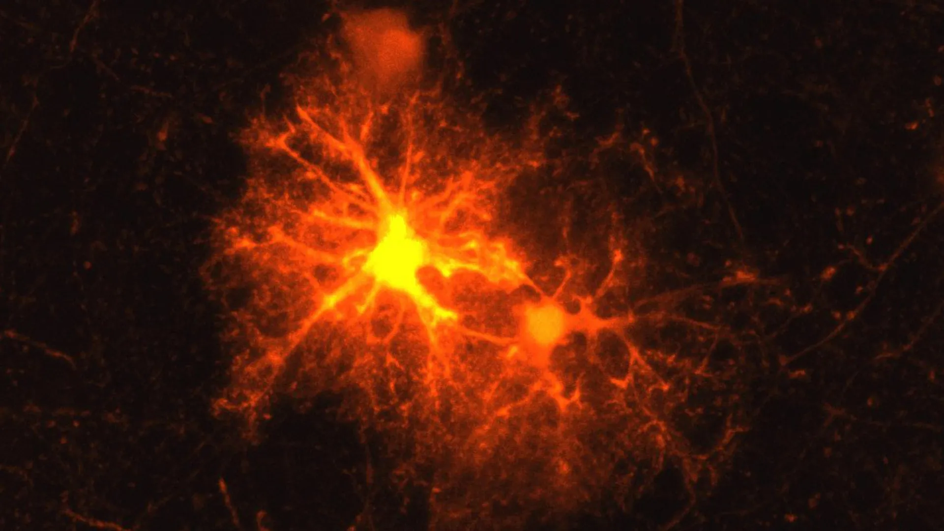 A stress hormone may help the brain repair itself