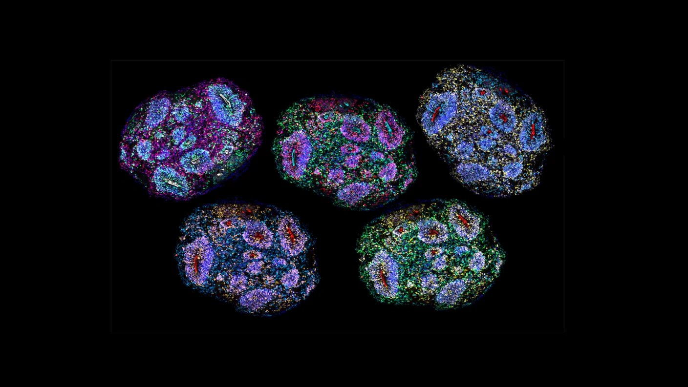 Mini Brains Grown for Five Years Matured Like Human Brains