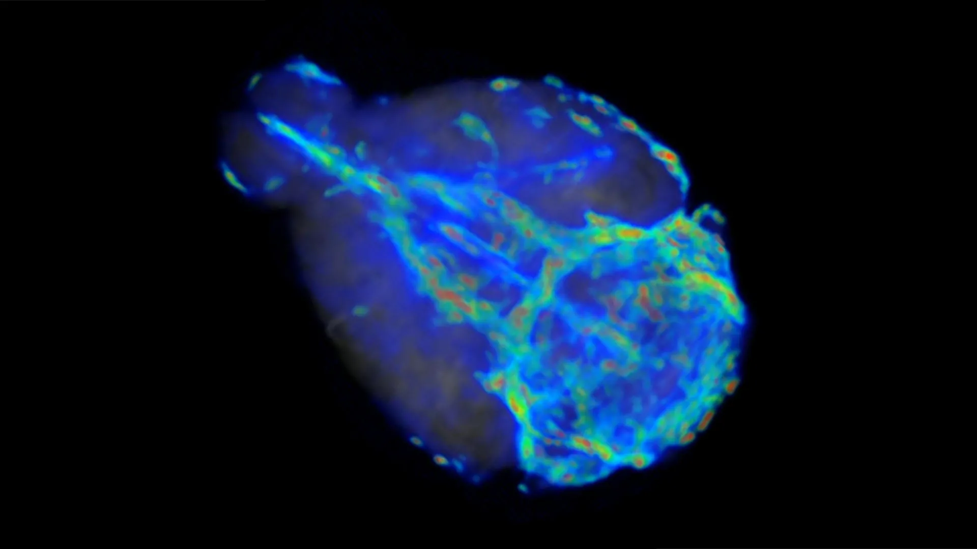 Scientists discover the brain has a fast lane and slow lane for clearing waste