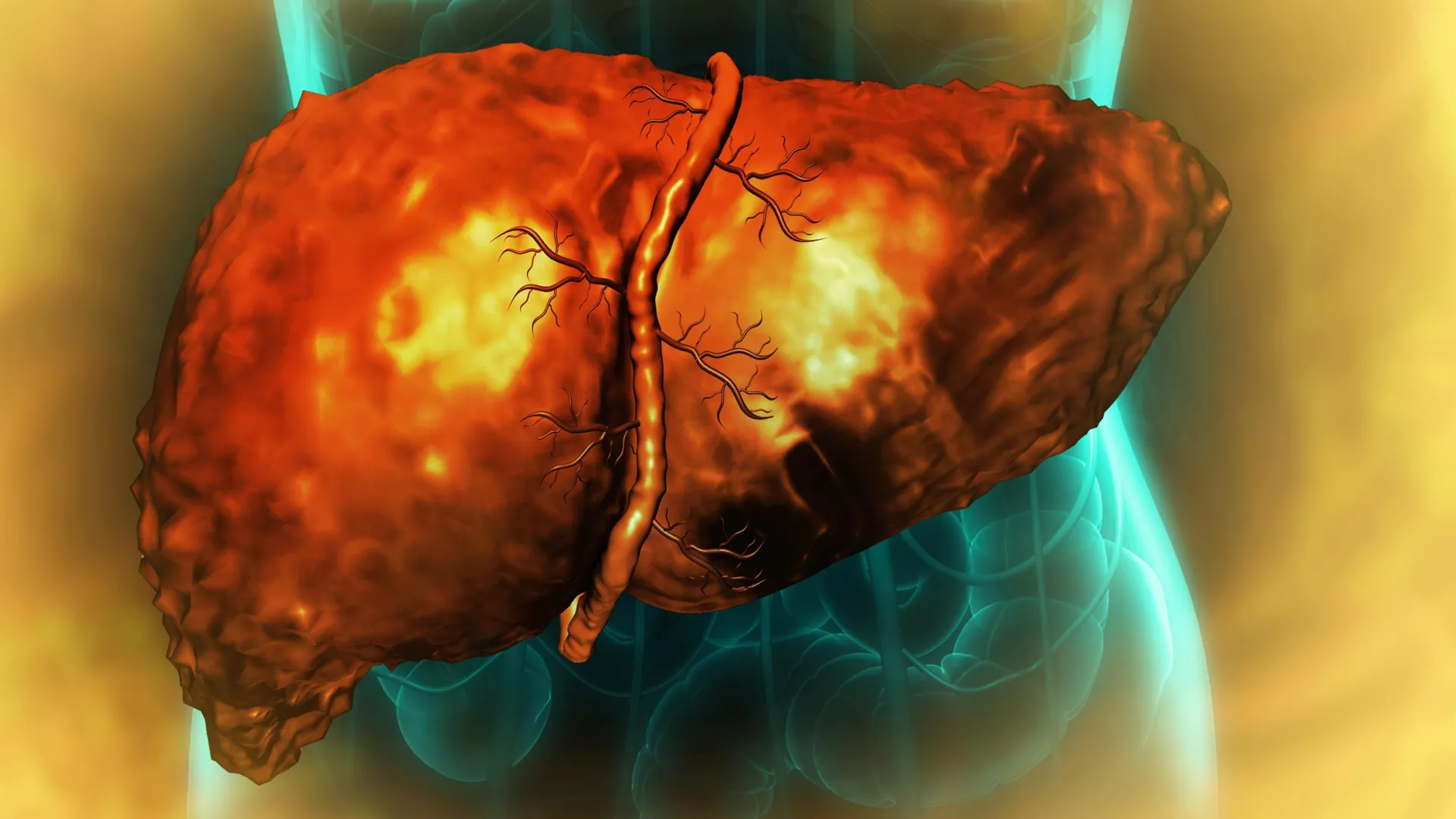 Scientists find why the liver may not heal even after you stop drinking