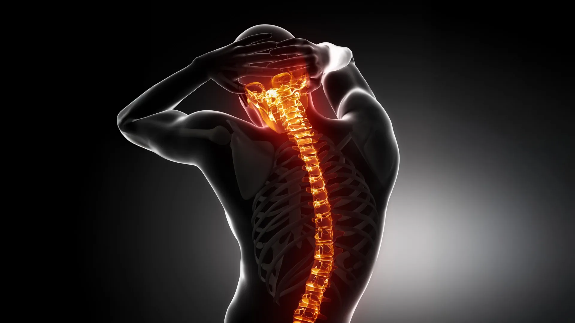 A drug already used for osteoporosis blocked spinal damage in a new study