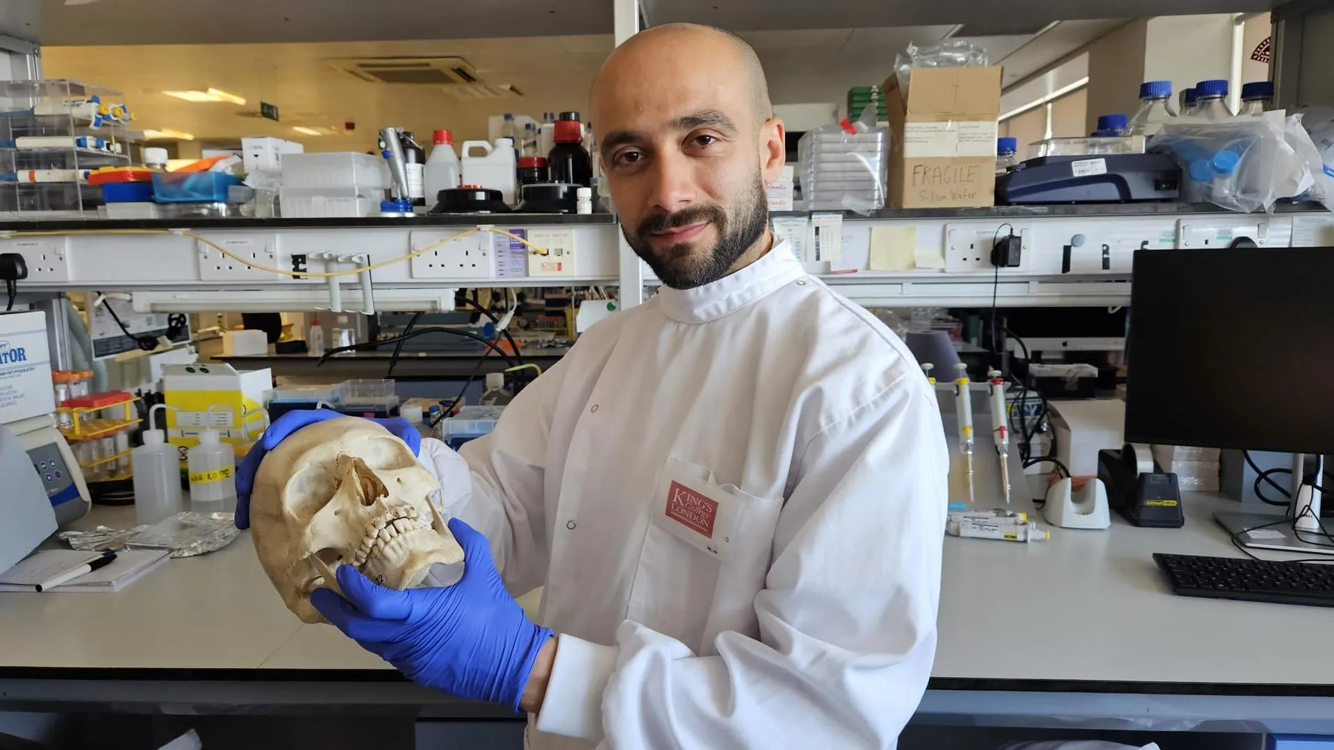 Scientists turn sheep’s wool into a material that helps regrow bone