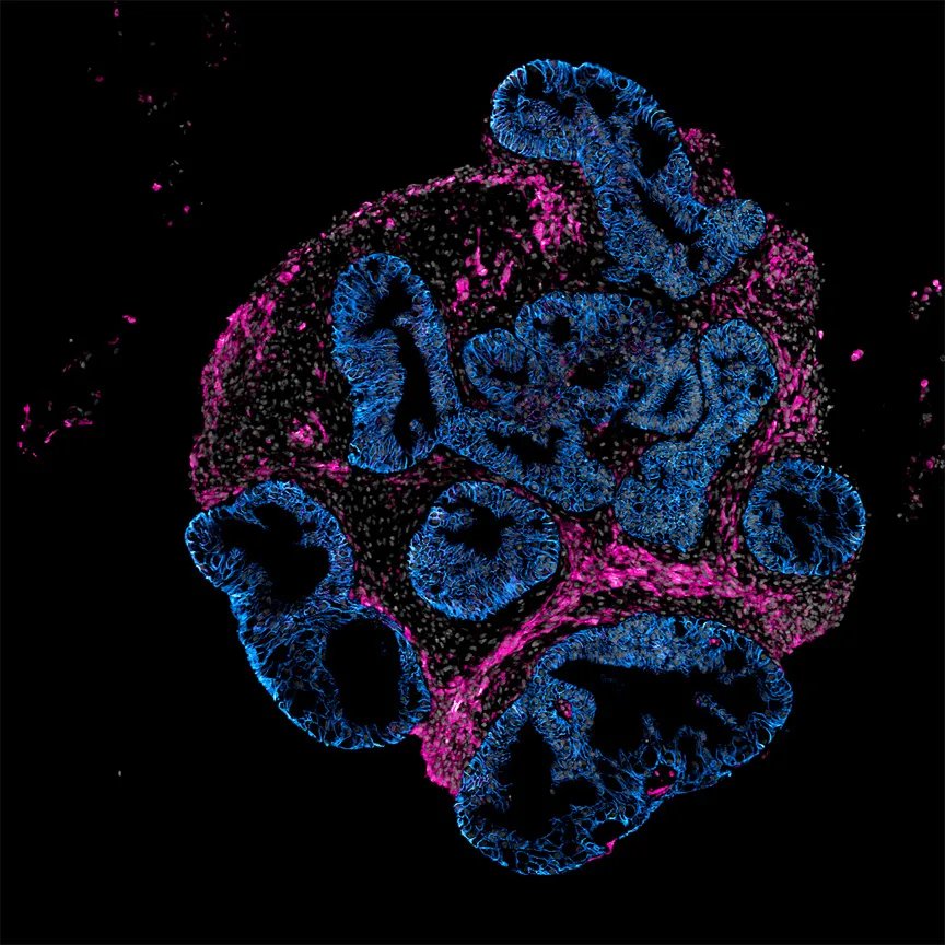 Intero Biosystems wants drugmakers to test on mini human intestines, not animals