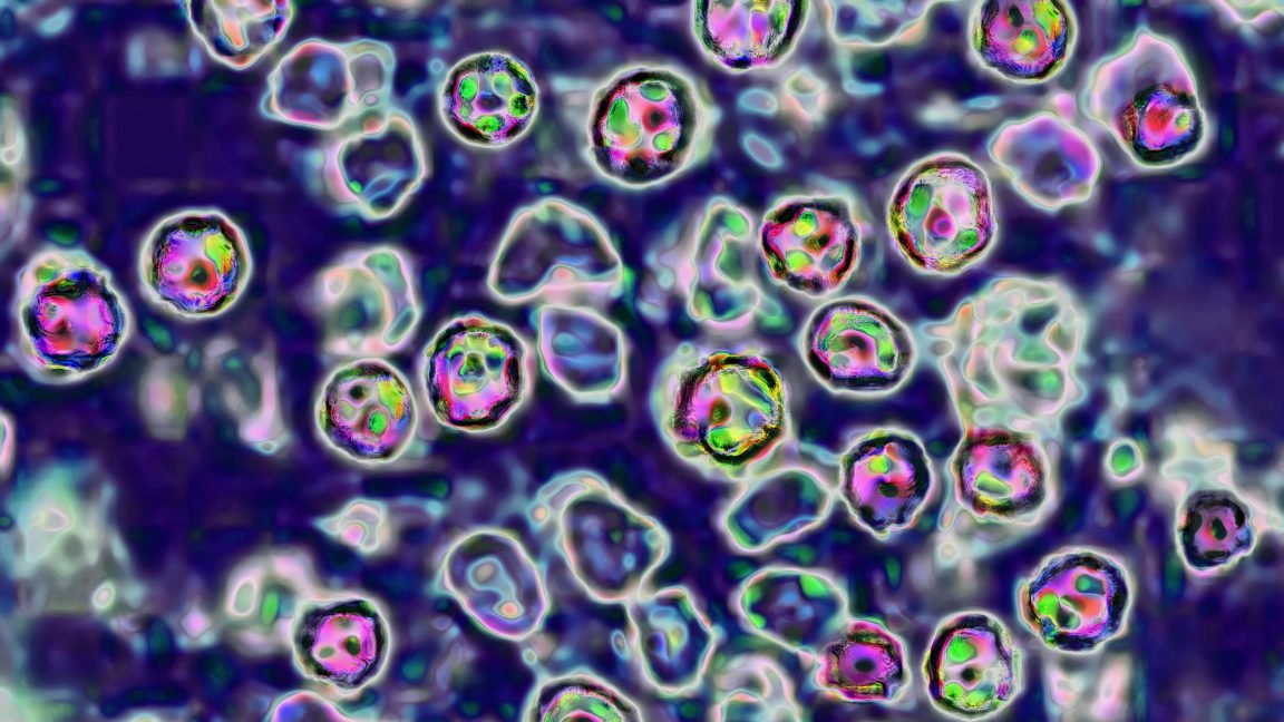 39-year-old unvaccinated woman becomes 6th measles death in Pennsylvania