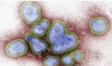 SARS outbreak contained worldwide